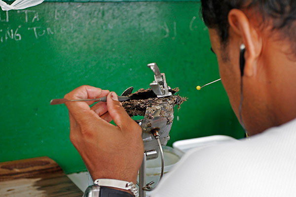 L'introduction du nucléus dans la poche perlière.